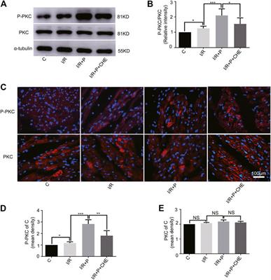 Propofol Inhibits Ischemia/Reperfusion-Induced Cardiotoxicity Through the Protein Kinase C/Nuclear Factor Erythroid 2-Related Factor Pathway